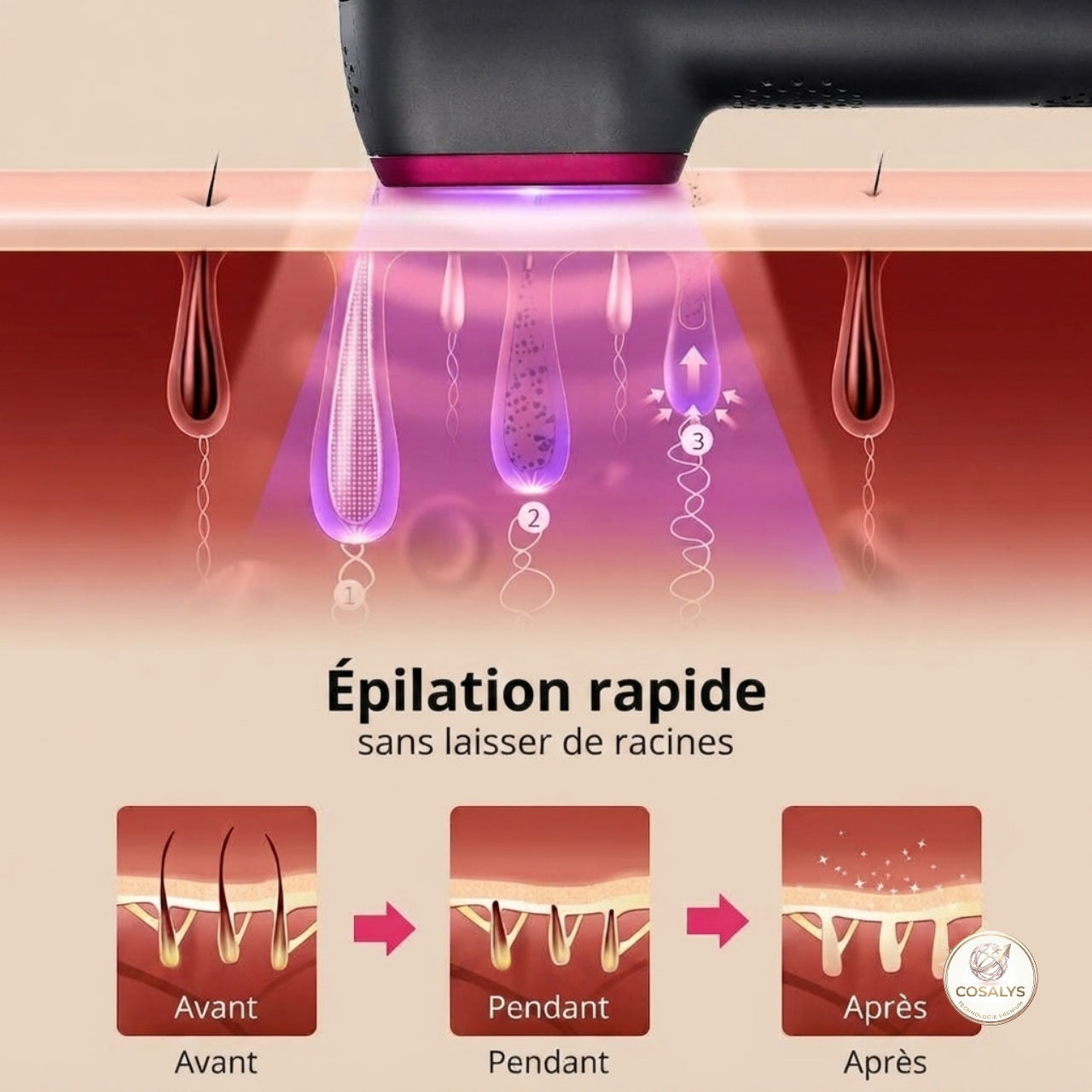 Ėpilation lumière pulsée intense IPL professionnelle - épilateur